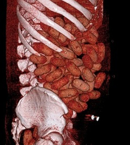 ART_cocainebagsbelly