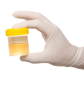 urine-sample