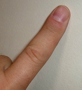 finger