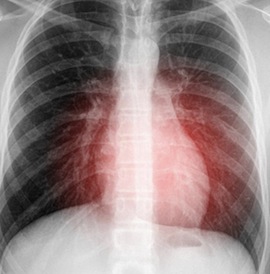 article-heart-1225-1