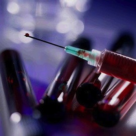 DUI-Blood-Test - st louis