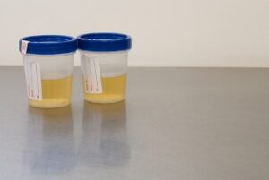 urine samples
