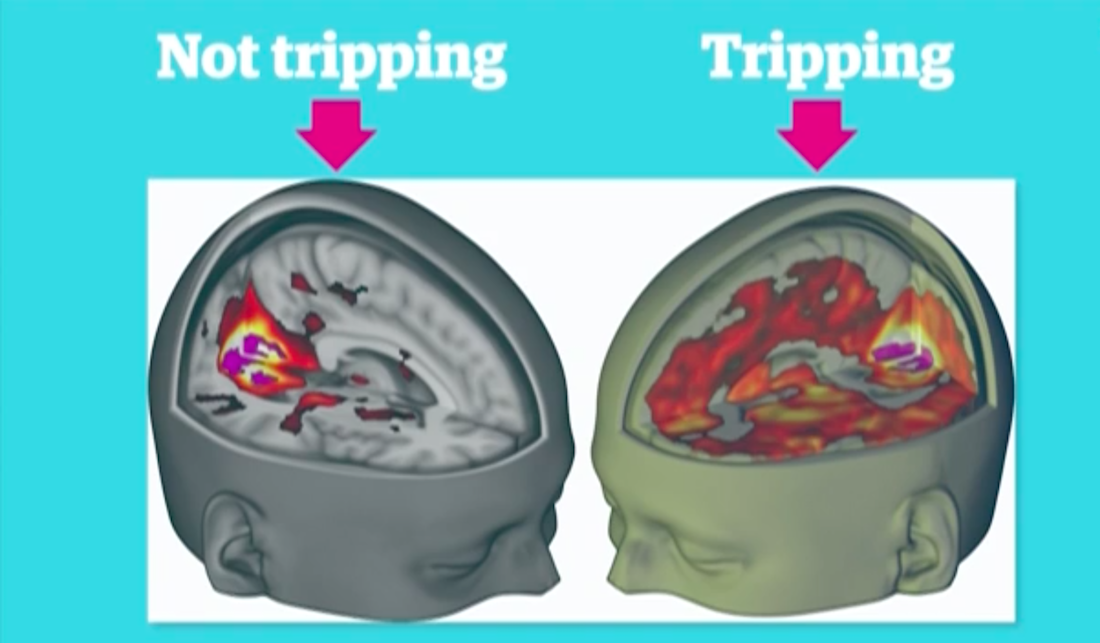 First-Ever Study Examines Effects Of LSD On The Brain