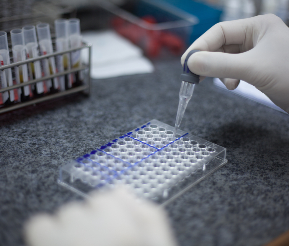 gloved hands performing an HIV test