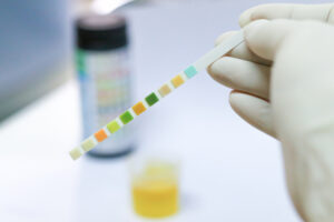 Urine Test Strips
