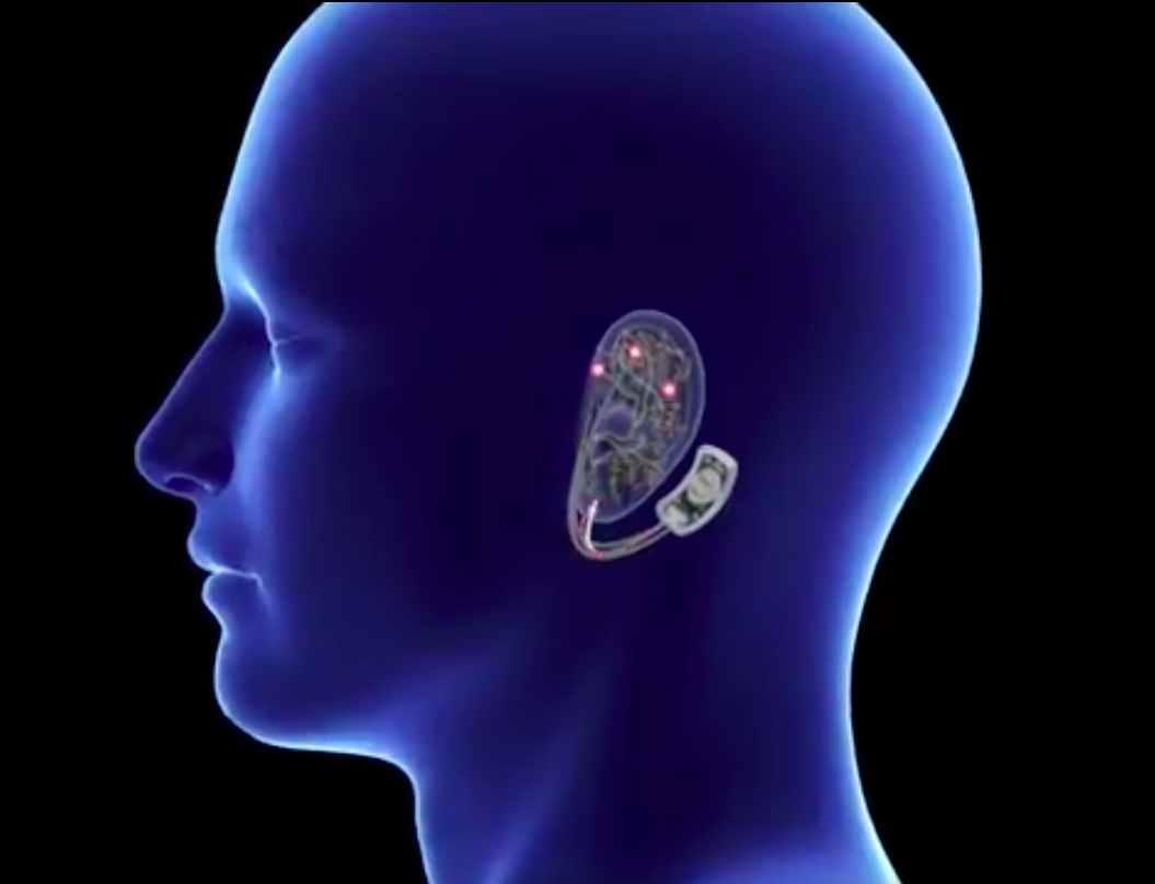 simulation of the bridge device