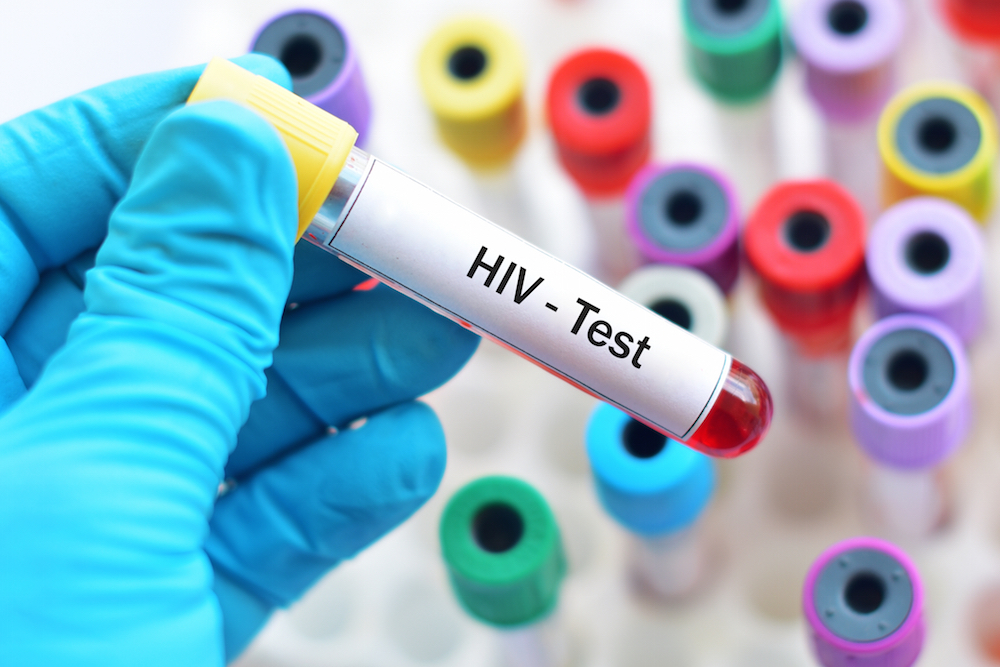 Blood sample for HIV test