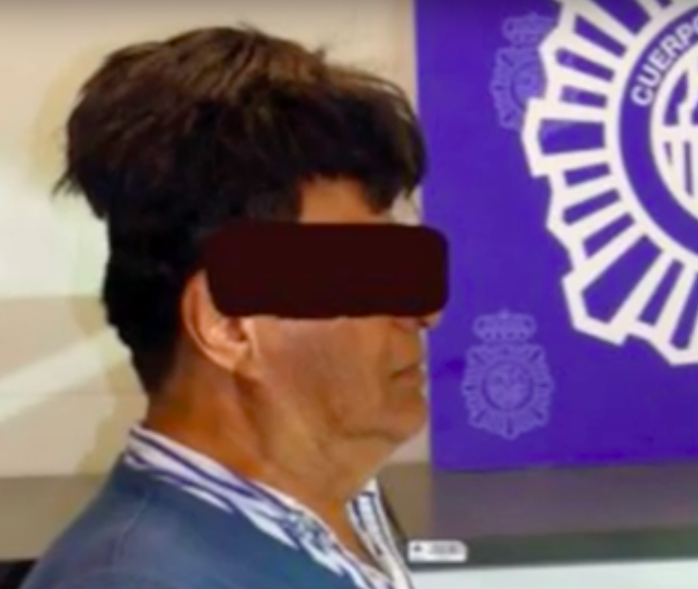 man in "curious" toupee