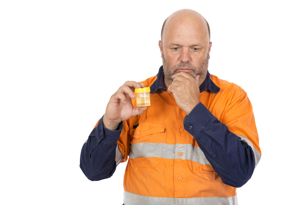 employer holding a drug-testing cup